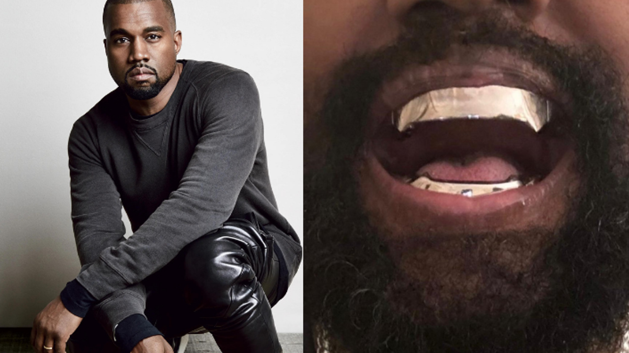 Kanye West'in kendi tasarladığı dişlerin bedeli dudak uçuklattı!