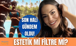 Demet Özdemir'in son hali olay oldu! Estetik mi yaptırdı?