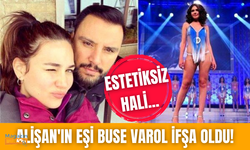 Alişan'ın eşi Buse Varol'un estetiksiz fotoğrafları ifşa oldu!