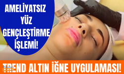 Altın iğne uygulamasının cilde etkileri nasıl olur? | Kimler yaptırabilir?