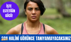 Survivor Sabriye Şengül'ün değişimini görenler gözlerine inanamadı