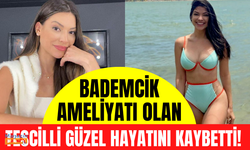 Aile perişan! Bademcik ameliyatı olan güzellik kraliçesi hayatını kaybetti