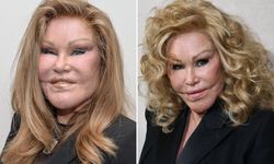 Estetikleri yüzünden 'Kedi Kadın' diye adlandırılan Jocelyn Wildenstein'in gençlik haline şok olacaksınız