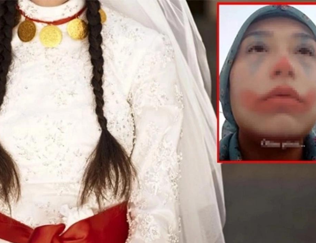 Niğde'de çocuk gelin skandalı! Türkiye 15 yaşındaki 'Elma Şekeri'ni konuşuyor!