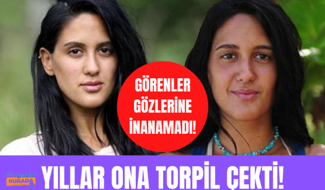 Survivor Sahra yaptırdığı estetikle bambaşka biri oldu!