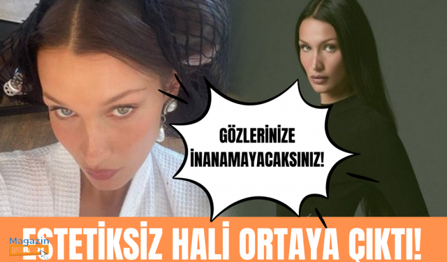 Bella Hadid'in estetiksiz hali görenleri şoke etti