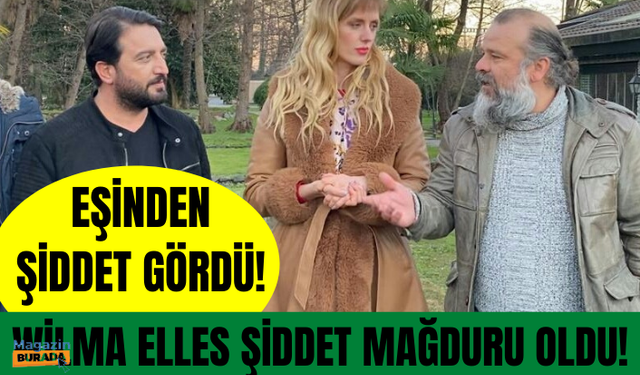 Wilma Elles şiddet mağduru oldu!