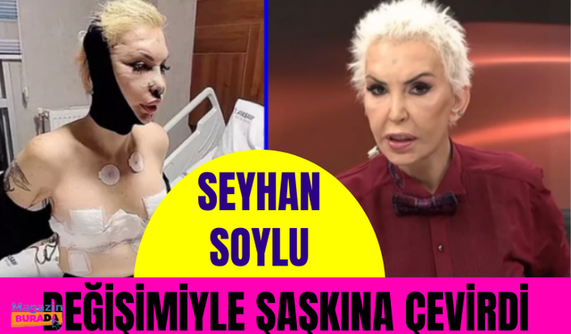 Filiz Akın'a benzemek için 10 ameliyat geçirip 1 milyon lira harcayan Seyhan Soylu, değişimiyle şaşkına çevirdi