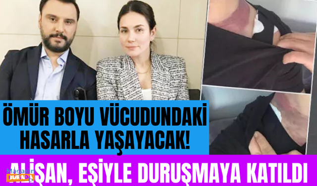 Hayatı boyunca vücudundaki hasarla yaşayacak! Doktoruna tazminat davası açan Alişan, eşiyle duruşmaya katıldı