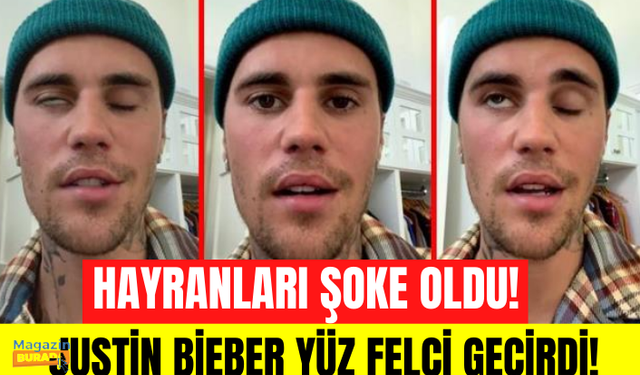 Justin Bieber yüz felci geçirdi! Sadece bir gözünü oynatabiliyor