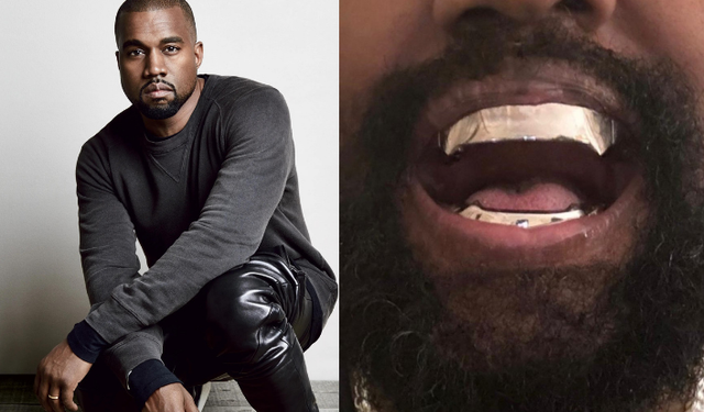 Kanye West'in kendi tasarladığı dişlerin bedeli dudak uçuklattı!