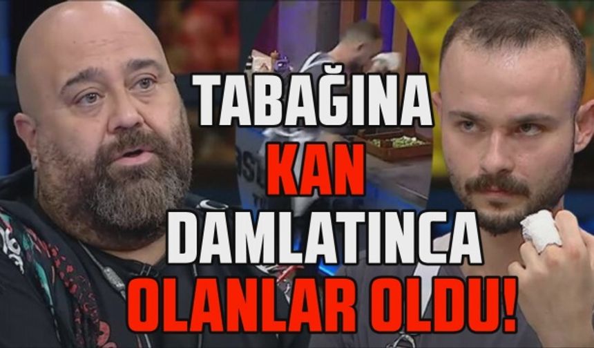 MasterChef 2021'de büyük talihsizlik! Elini kesen yarışmacının kanı tabağına bulaştı...