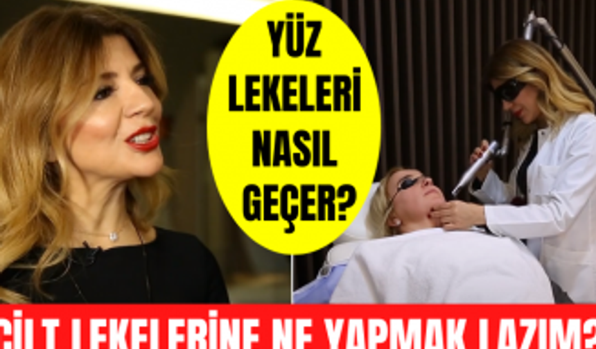 Cilt lekelerine ne yapmak lazım? Yüz lekeleri nasıl geçer? Yüzdeki lekeler doğal yolla nasıl geçer?